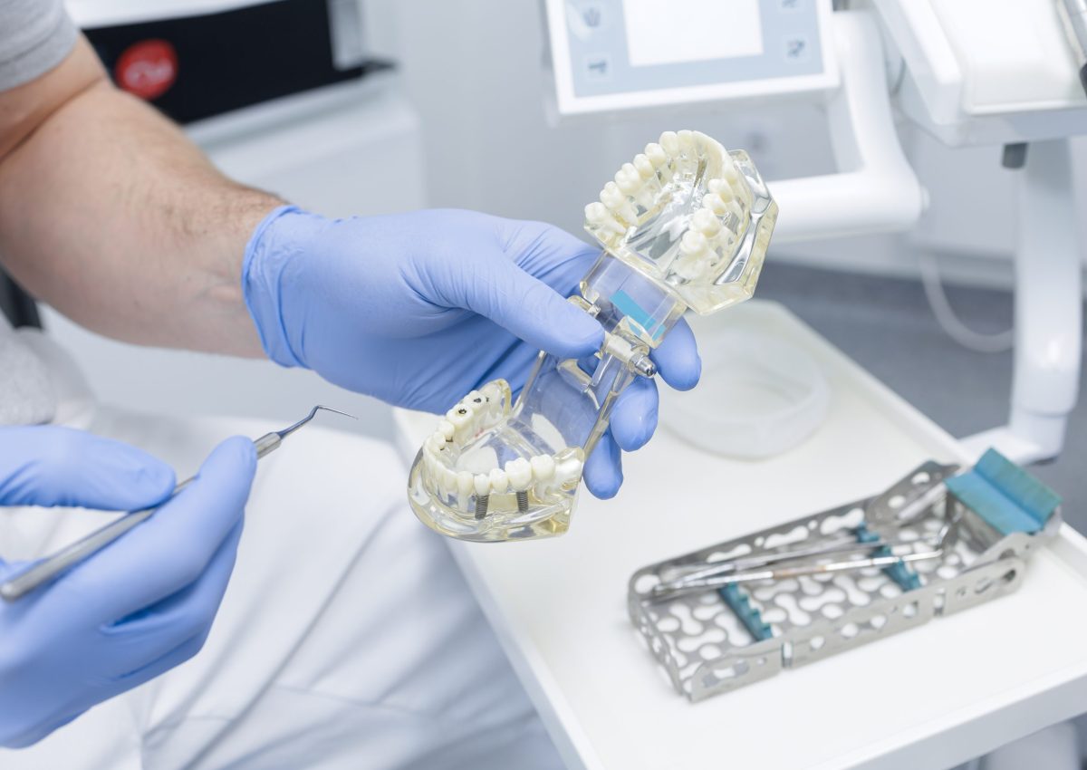 Gloved,Dentist,Holds,Implant,Jaw,Model,And,Explains,Tooth,Replacement
