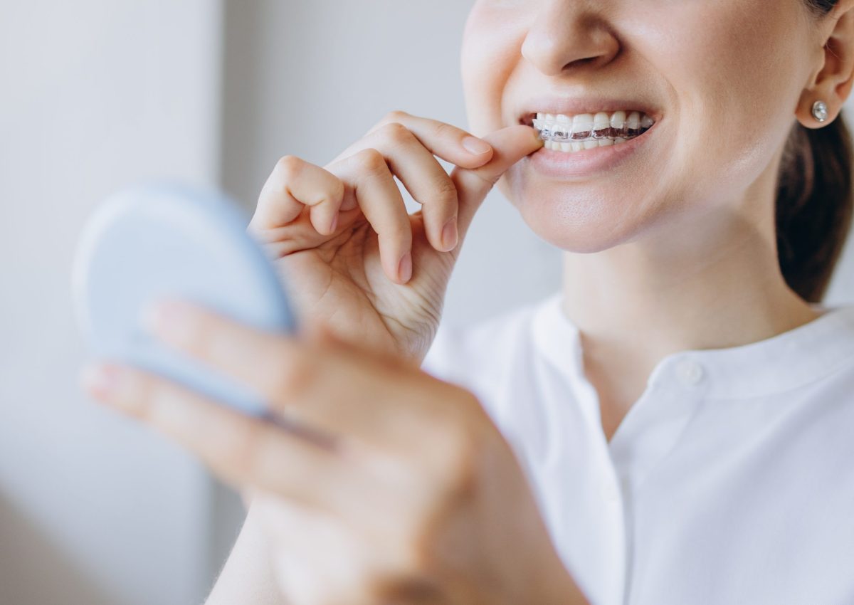 Woman,Putting,On,Invisible,Removable,Braces,Aligner,,Orthodontic,Treatment,To